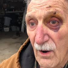 Maine fox attacks surge in the Midcoast with more than half a dozen in just  6 months