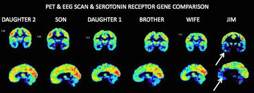 We did not find results for: What A Psychopath Brain Looks Like