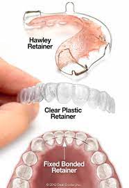As mentioned above, it's important to wear your after this period of time, wearing your retainers overnight should help keep your teeth aligned properly. After Braces Always Wear Your Retainers