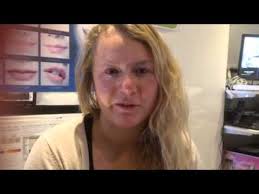 Eyeliner tattoo at Rejuvenate Now