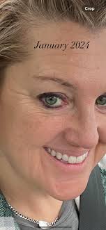 Rowe Casa Organics products for skin improvement and anti-aging