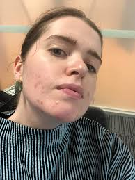 Please help, my face has so much going