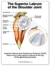 At the top of the glenoid (the 12 o'clock position) the long head of the biceps tendon attaches. Slap Superior Labrum Anterior To Posterior Tear