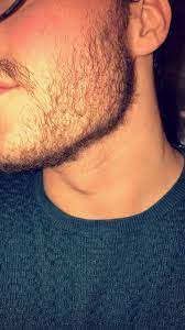 Unfortunately, the ability to grow facial hair depends largely on your genetics. Age 21 First Time Growing Out 3 Weeks Of Growth Concerned About My Hairs Being To Thin Or Will It Stop Being See Through After Some Time Beards