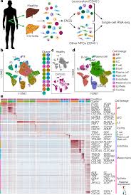 Resolving The Fibrotic Niche Of Human Liver Cirrhosis At