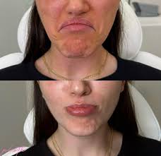 PLSTK ™️ Aesthetics