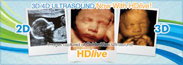 3d Ultrasound In Chicago Illinois