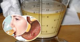Resultado de imagen para imagen batido de papa para la gastritis