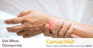 Thyroid cancer develops in the thyroid gland, a part of the endocrine system. Thyroid Problems Cancer Net