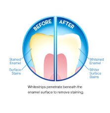 Crest whitestrips were introduced in 2001. Buy Crest Whitestrips Supreme Professional Whitening Strips