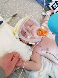 Our Staff S 5 Month Old Baby Boy Frank Zillins Who Needs A Heart Transplant Re Max Real Estate Dewitt In Great 5 Month Old Baby Sick Kids How To Raise Money