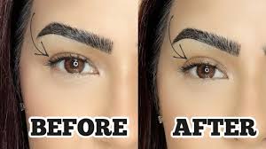 Is eyelid surgery the only way i can get rid of eye bags! How To Lift Hooded Eyes Without Surgery Eyelid Tape Youtube