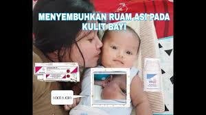 Ruam di perut bayi mungkin juga gejala biduran, yaitu masalah kulit yang ditandai dengan bentol merah yang melebar dan terasa gatal. Obat Ampuh Menyembuhkan Ruam Asi Pada Kulit Bayi Review Sebamed Protective Facial Cream Youtube