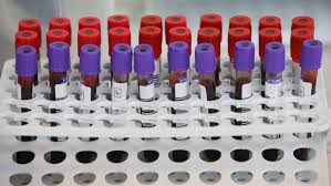 Carabina pentru fixarea cheilor, sau a unei lanterne mici. Studiu Nicio GrupÄ De Sange Nu E Mai VulnerabilÄ La Formele Grave De Covid 19 AÈa Cum Se Credea