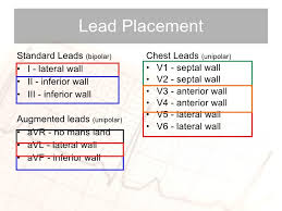 Ecg Interpretation The Basics