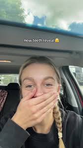Unveiling the Stunning Transformation: New Teeth Reveal