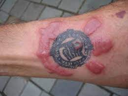 Your tattoo is a wound that your body is actively healing. How Long Does It Take For A Tattoo To Heal Completely 2021 Guide