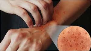 Image result for à¤¦à¤¾à¤¦ à¤à¤¾à¤ à¤à¥à¤à¤²à¥