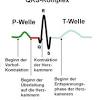 Die bezeichnung stemi beschreibt eine von mehreren formen des herzinfarktes. 1