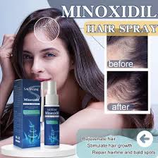 Image result for Minoxidil