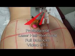 Singapore waxing video ( brazilian wax,waxing) report. Professional Laser Hair Removal Brazilian Bikini Agaclip Make Your Video Clips