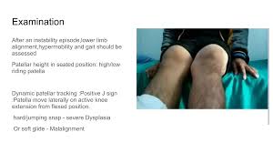 Image result for Patella Tracking Assessment