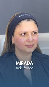 Con nosotros Luciana Geuna!🩷 Te contamos como ella año a año confia en  nosotros para tener su piel saludable.✨ Hace como ella y cuida tu piel!  Solicitá tu CHEQUEO BEAUTY ahora al: +