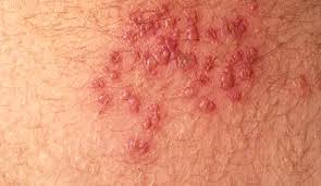 Pin On Armpits
