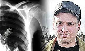 Once the seeds are mature, the female plant begins to die, and seeds are either dropped to the ground where they germinate and grow into new cannabis plants the next spring, or they are harvested for processing. Shocked Russian Surgeons Open Up Man Who Thought He Had A Tumour To Find A Fir Tree Inside His Lung Daily Mail Online