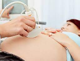 Maybe you would like to learn more about one of these? Screening Alternative Zur Fruchtwasser Untersuchung Kidsgo