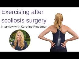 how to exercise after scoliosis surgery