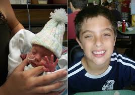 Side-By-Side Preemie Photos Show How Far These Little Fighters Have Come