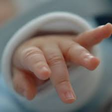 Intervienen a bebé que nació con tres penes – Publimetro Chile