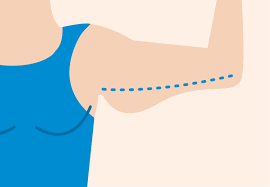 Each dressing lasts, on average, 10 days when skin is prepped properly and dressing is applied per instructions. 5 Ways To Fight Excess Skin After Your Bariatric Surgery Health Essentials From Cleveland Clinic