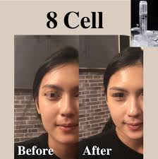 谁说过了35岁的女人才想逆龄？ 20出岁美女也想冻龄呢,不多说，  看效果🥰，昨晚在闺蜜的生日会，给这位美女喷了半边脸明显看见效果直接入手一瓶，也考虑加入代理了👏👏👏🌟，𝟖𝐂𝐞𝐥𝐥好棒的产品🥳🥳🥳