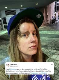 This is too good. 😂 Topps made a baseball card for Liz McGuire, the Blue  Jays fan who took a 110MPH Bo Bichette foul ball to the face. 😭👏 (📸:  Topps, lizzzzzzzzzzy/X)