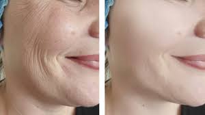 This coveted face shape refers to a slim and oval face that narrows down to a sharp end at the chin. 3 Ways To Tighten Face Skin Wikihow