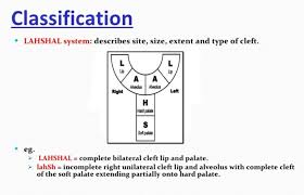 Lahsal Classification System For Cleft Lip Palate Note Capital Complete Small Incomplete Medical Mnemonics Soft Palate Cleft Lip