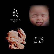 In a world full of 4D….. have you thought about upgrading to 8K? Sharing  some lovely before and after of 4D to 8K. Can you see the newborn  comparison too? 👶👶🏻👶🏼👶🏽👶🏾👶🏿 #heybaby4dhull #
