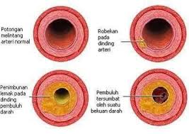 Herba semulajadi berfungsi sebagai agen detoksifikasi hati, menjaga kesihatan hati, meransang jagalah kesihatan usus anda semasa masih sihat. Jom Detoks Dan Cuci Usus Dengan Aloevera Gel Bersihkan Longgokan Najis Yang Berkumpul Didalam Usus Dengan Selamat Dan Berkesan Kempiskan Perut Dan Buang Lemak2 Jahat Dalam Badan Dengan Cara Semulajadi Kenapa Ye