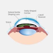 Image result for Sclera