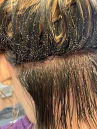 Months Of Lice Hair Styles Lice Eggs Hair