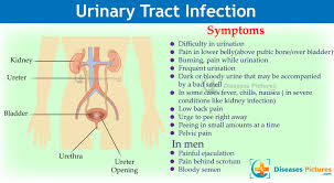 Symptoms of a urinary tract infection (uti) are similar in men, women, and children. Natural Home Remedies For Urinary Tract Infection Uti Symptoms Treatment Healthmd