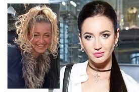 Пластика и другая работа над новой внешностью после развода. Olga Buzova Do I Posle Plastiki Na Peopletalk