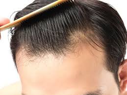 The key here is to be consistent. Thicken Your Hair 11 Clever Hair Thickening Tips