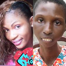 '﻿Doctor say di sickness no get cure but me I no believe for myself say e  no get cure becos I believe say I go well one day.', 27 year-old Violet  Nicholas dey suffer from one rare health condition wey ...