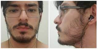 My biggest complaint—and no one i know seems to share this—is a sudden abundance of light facial hair! 20 Have Facial Hair That Runs Just A Bit Below My Eyes Will This Ever Fill In Or Should I Shave It Beardadvice