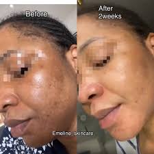 Emeline Luxury Skincare