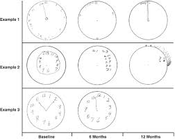 Put in all of the numbers and set the time to 10 after 11. scoring: Clock Drawing Test Springerlink