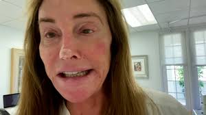 Caitlyn marie jenner (born william bruce jenner; Caitlyn Jenner S Battle With Skin Cancer Heavy Com